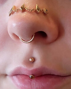 Anara's Nose